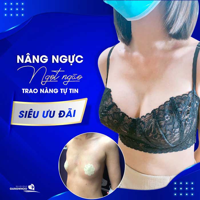 Nâng ngực ở đâu tại Quảng Nam đảm bảo an toàn