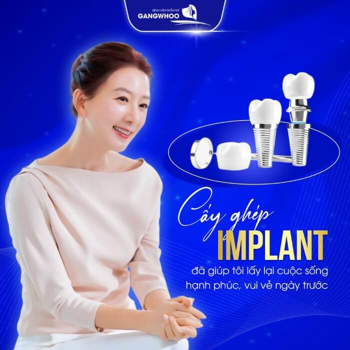 Quy Trình Cấy Ghép Implant Tức Thì Hiệu Quả Tại Bệnh Viện Thẩm Mỹ Gangwhoo