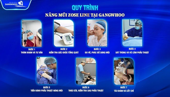 Quy trình nâng mũi Zose - Line chuẩn Y khoa tại Gangwhoo