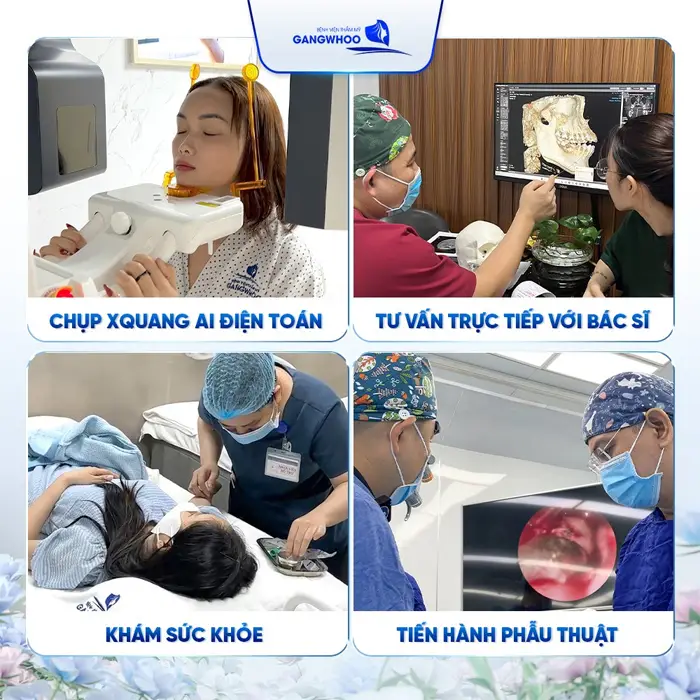 Gợi Ý 4 Cơ Sở Nâng Mũi Ở TPHCM