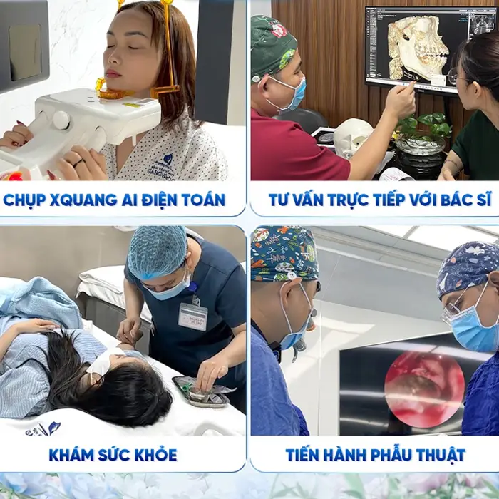 Bật Mí 3 Cơ Sở Nâng Mũi Ở Long An Đẹp Và An Toàn