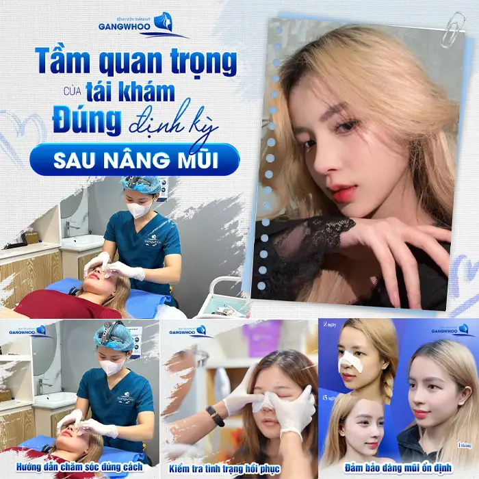 Không Cần “Săn Deal” – Đây Là Những Địa Chỉ Nâng Mũi Ở Đồng Tháp Đáng Tiền Nhất!