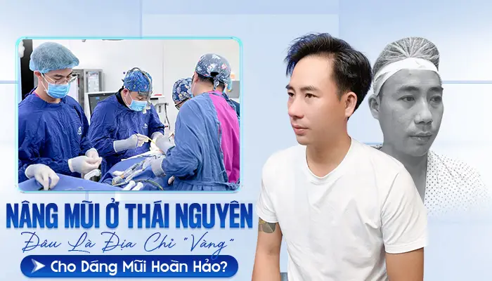 Nâng Mũi Ở Thái Nguyên: Đâu Là Địa Chỉ “Vàng” Cho Dáng Mũi Hoàn Hảo?